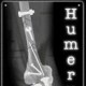 HumerusOnline