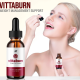 thevittaburnbuy