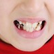 Smyrna Kids Dentist